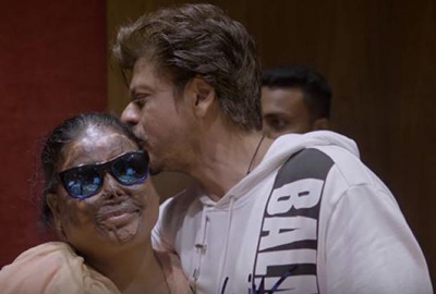 SRK's special gesture for acid attack survivors will melt your heart
